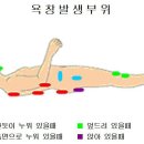 욕창 발생부위 (첨부파일 / 한글문서, 정음글로벌 문서) 이미지