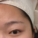 메디베드 | 대구피부관리 데자뷰메디스킨 대구점 이온토 미백관리 후기