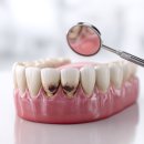 강산치과기공소 | 대전네비게이션임플란트 정리해보면