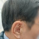 와이덱스 보청기 강남점 이미지