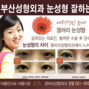 부산 쌍커풀 수술 후기~ 절개법 부산 눈성형, 부산성형외과 이미지