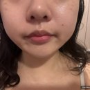 은하스킨케어