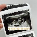 가나종합광고 | 태아보험 가입 내돈내산 후기 총 정리