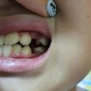 거기치킨 이미지