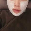 미소핀피부과의원 | 내돈내산 논현동 피부과 리니어지 압구정 리프팅 3주차 솔직후기(효과,비포에프터)