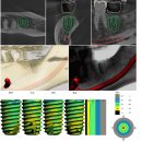 정담외과의원 | 나주 임플란트, 네비게이션으로 정확하게! KS 최고등급 임플란트로 통증·오차 줄이다