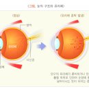 밝은힐링안과의원 이미지