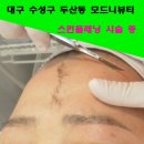 모드니헤어라인