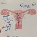 윈산부인과의원 | [유방암 타목시펜 부작용] 자궁내막 두꺼워져 조직검사 한 후기(+골밀도 검사 결과)