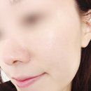 경원대로 1395(부평일번가) 앞 | 부평아쿠아필 부평피부관리 데자뷰메디스킨 인천점