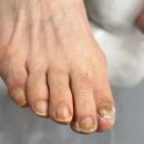 문제성 손, 발 오감네일 | 미추홀구무좀 문제성 손, 발 오감네일 도화점에 발톱무좀으로 고생하시는 엄마모시고 다녀왔어요