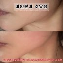 헤어승 | [수유역 피부관리] <미인본가 수유점> 얼굴라인관리 웨딩관리 잘하는 곳 1회차에 바로 만족하고 온 후기