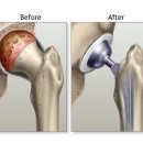 씨티재활의학과요양병원 이미지
