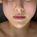 미즈앤 - 청주시 상당구 중앙로 28-1 | 잠원동 피부관리 웨딩케어 v라인 윤곽관리 미즈스킨앤바디 솔직후기