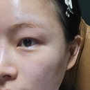 라파의료기 | 암환자선물추천 라파앤코 의료진 추천까지 받은 민감피부 맞춤 솔루션 후기