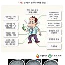 알콜이 인체에 미치는 영향 ( 알콜성 치매 ) 이미지