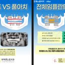 뿌리치과기공소 이미지