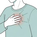 가슴 통증 원인, 심장 문제 vs 식도염 vs 늑간 신경통 구별 이미지