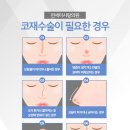 일치성형외과의원 이미지