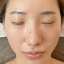 서동로8길 | [익산 올가드림 동산점] 익산 동산동 피부샵 모공디톡스 물광관리 만족 후기