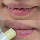 대지메디홈 | 입술각질 부자 들어와 찢어진입술 응급립밤 블리스텍스 립릴리프크림
