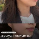 닥터남아름다운의원 | 수원 피부과 유목민 추천 올타이트리프팅 키닥터원장님 리얼후기 효과 내돈내산