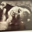 아이투비 산부인과 앞 이미지