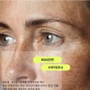 뉴세라