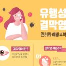 결막염 원인 증상 알레르기성 결막염 감염성 결막염 전염성 치료 예방법 이미지