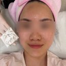 [천안 예신피부관리] 천안 스킨플래닝 맛집 발견, '눈썹가게'에서 매끈한 피부 만들고 온 솔직 후기