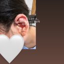 임산부 교통사고_(1) (중상)| 23주차 |의정부 성모병원 입원 후기