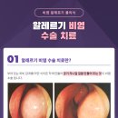 부산행복마취통증의학과의원 네이버블로그