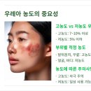 빛나약국 | 우레아 단독 사용 조심! 약국 연고, 크림의 핵심은 성분 배합과 함량
