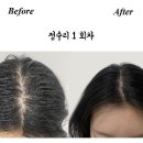 일산두피문신잘하는곳 쿤스트디뷰티연구소