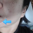 (주)에스에이치 | [체험단] 슈알리아 SHC-100 뉴트리션 앰플 4주 사용후기