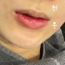 중랑 | 양씨네 눈썹학교 | 입술 반영구 솔직후기_중랑구 사가정눈썹 입술 잘하는 곳