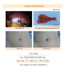 담석증수술후기. 첫 내원시 원장님이 친절하시고 잘 설명해주셔서 믿음이 생겼다. 이미지