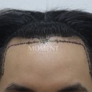 모먼트의원 이미지