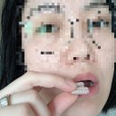 꼬미PC | [헬퓨] 👀 비문증영양제 고민될 때, 눈에날파리 원인부터 챙긴 헬퓨 브로멜라인 클리어컷 후기 👀