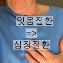 <6월23일 에서 6월 30일 >입냄새와 장내세균,성조숙증과 호르몬,잇몸질환과 치매,심장질환,여름철건강관리,흰설탕.황설탕,흑설탕,신생아,면역, 이미지