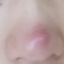 비에이성형외과의원 이미지