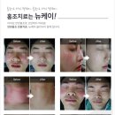 뉴의원 네이버블로그