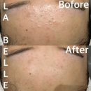 라 벨르 에스테틱 이미지