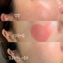 드림메디 | AMEDEE아메디 멜드림 클렌징젤 미세한 탄산버블로 모공노폐물까지 깔끔하게