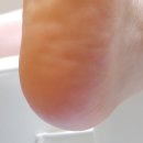 레푸스앤스타일 일산장항점 | 일산 발각질 잘하는 곳 레푸스 일산장항점 프리마토탈케어 후기