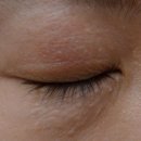 플렉스피부과의원 이미지