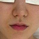 아느크 에스테틱 네이버블로그