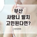 부산사랑니발치 고민된다면 믿을 수 있는 곳으로 이미지