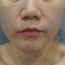 특허받은 수기테라피로 전신 힐링 받아요 청주얼굴경락 김나현에스테틱 방문후기