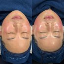 케이엠시스템 | 전국 최다 관리 인증 천안슈퍼젝션 후기 많은 케이엠에스테틱